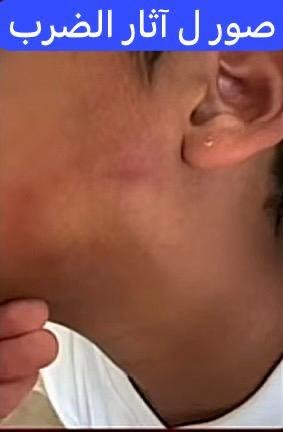 تطورات جديدة في واقعة نجل الفنان محمد رمضان.. اتهامات بالاعتداء والاحتجاز