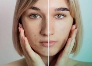 أثار الجروح