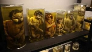 متحف الأجنة بالقصر العيني… ذاكرة الطب التي لا يراها الجميع