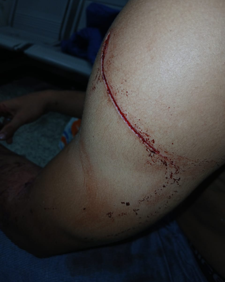 خاص | إستغاثة عاجلة: اعتداء أربعة أشخاص على أسرة في دار السلام وإصابتهم إصابات بالغة