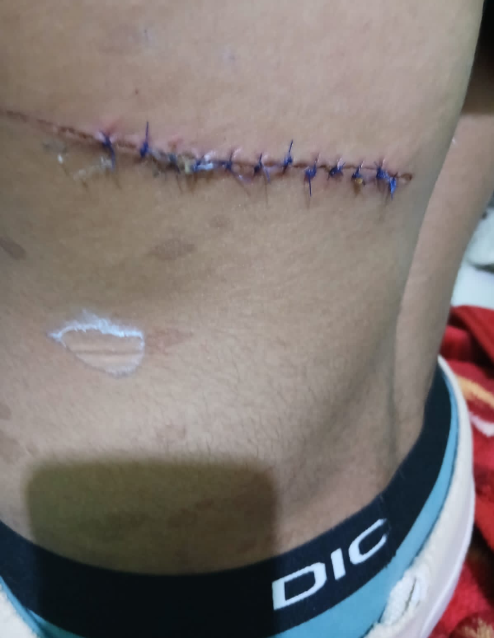 خاص | إستغاثة عاجلة: اعتداء أربعة أشخاص على أسرة في دار السلام وإصابتهم إصابات بالغة