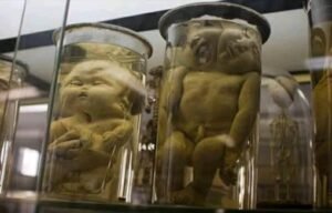 متحف الأجنة بالقصر العيني… ذاكرة الطب التي لا يراها الجميع