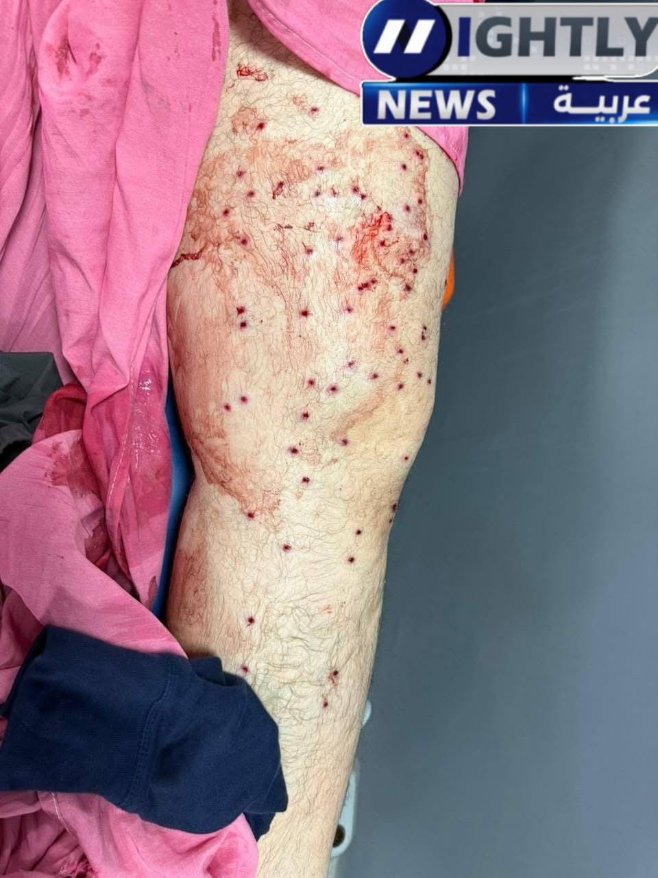 أب وطفله ضحية خرطوش وسلاح أبيض بعد التراويح